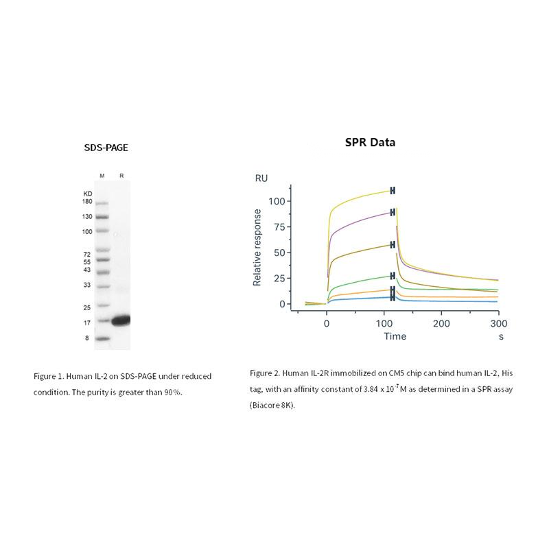 Rekombinant humant IL-2-protein, hans tagg _ 90103es