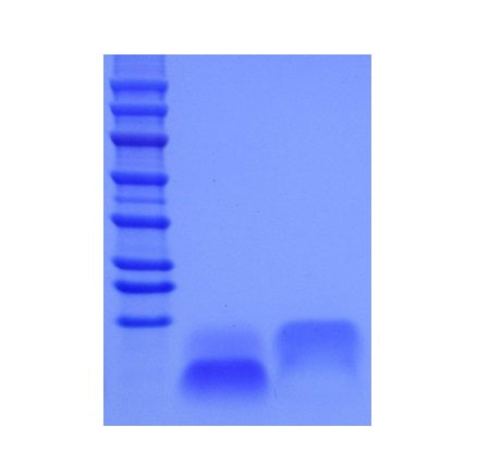 Proteina EGF umana _ 92708es