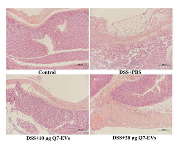 Colitcare ™ Dextran Solfato di sale di sodio (DSS), COLITIS GRADE MW: 36000 ~ 50000 _ 60316es