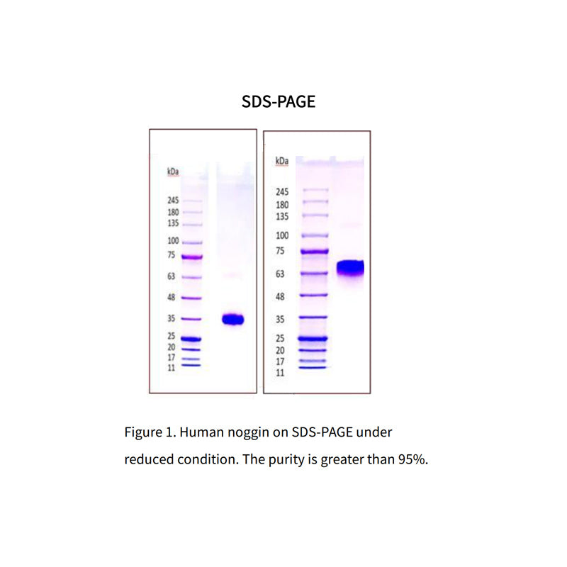 Recombinant Human Noggin Protein,His Tag _ 92528ES